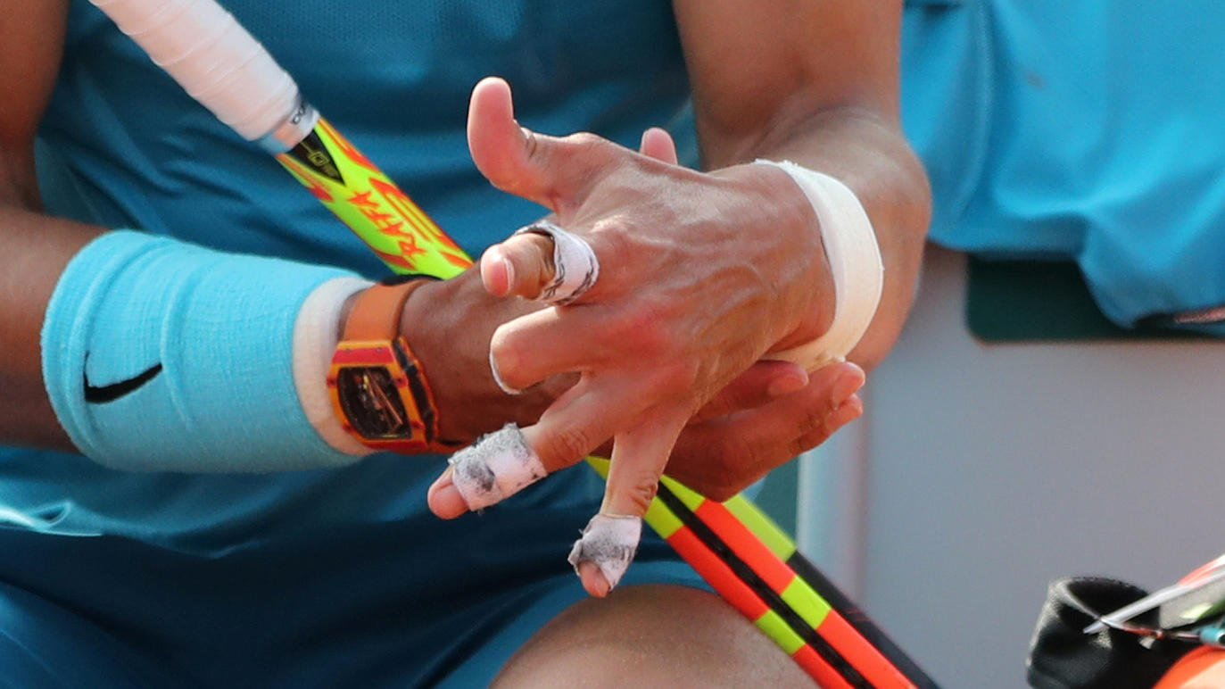 Der Unbezwingbare: Rafael Nadal gewinnt zum elften Mal die French Open TMan mag kaum hinschauen: Rafael Nadal kann im dritten Satz die Finger kaum noch bewegen