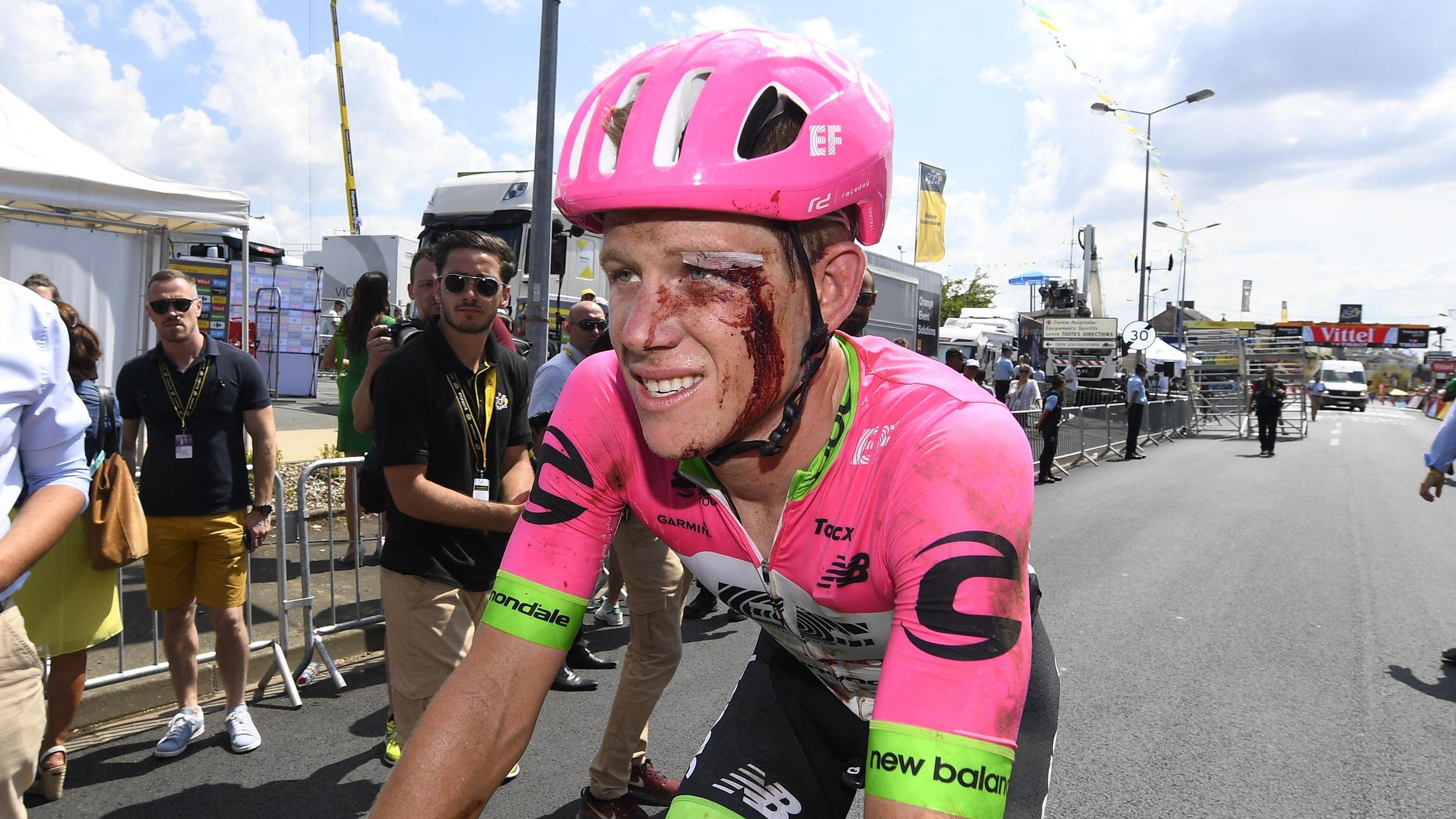 Tour de France: Radprofi fährt mit gebrochenem Schulterblatt - für den guten Zweck Lawson Craddock