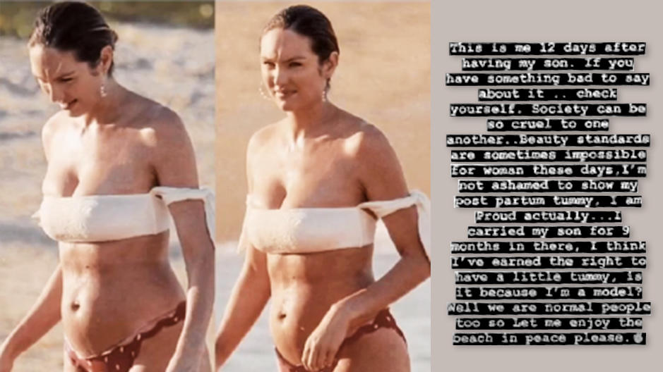 Candice Swanepoel wehrt sich gegen fiese Kommentare zu ihrem After-Baby-Bäuchlein Candice Swanepoel schämt sich nicht für ihren After-Babybauch