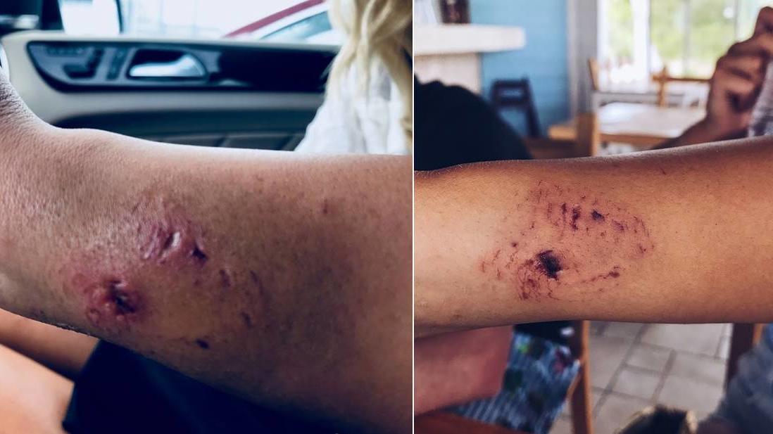 Instagram-Model Katarina Zarutski bei Shooting von Hai gebissen Katarina Zarutskie