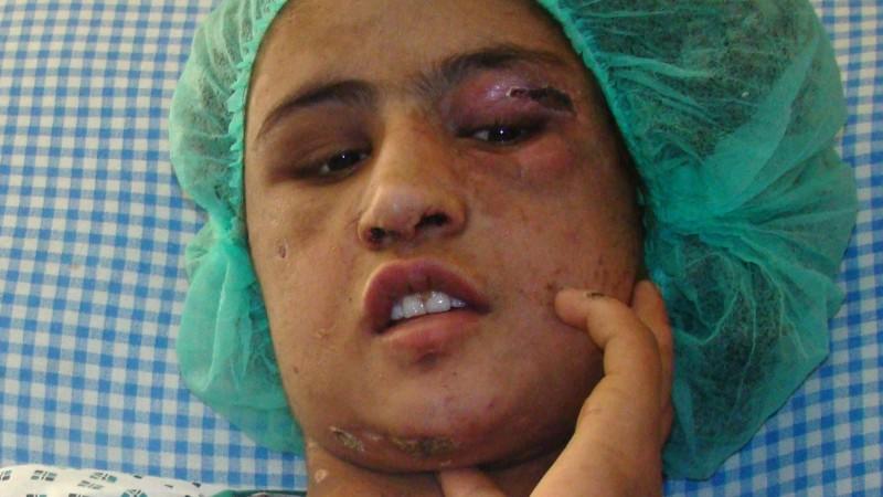 Afghanisches Mädchen (15) gefoltert Afghanisches Mädchen (15) gefoltert