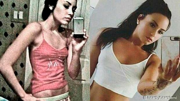 Demi Lovato schockt mit Magerfoto und Drogenbeichte Demi Lovato schockiert ihre Fans