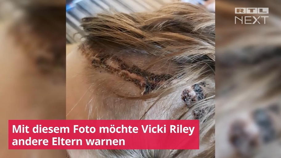 Schreckliche Bilder nach Fahrradunfall Schreckliche Bilder nach Fahrradunfall