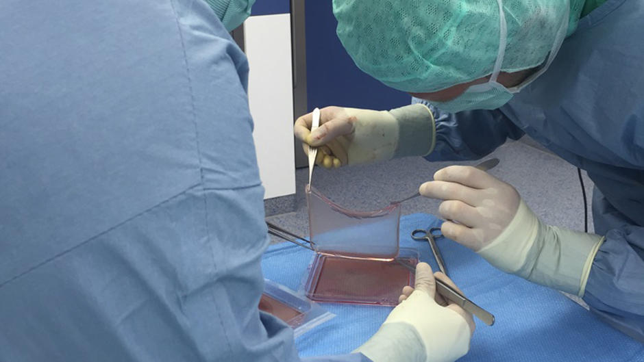 So konnten Forscher dem Schmetterlingskind helfen So konnten Forscher dem Schmetterlingskind helfen
